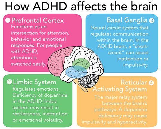 adhd brain impact - Bluestone Psych Meds